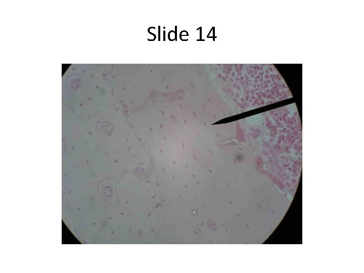 Slide 14 