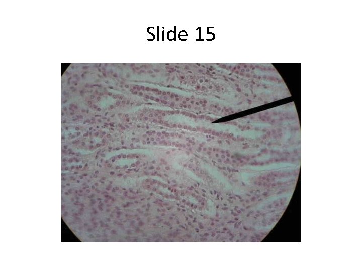 Slide 15 