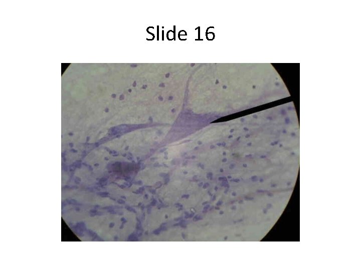 Slide 16 