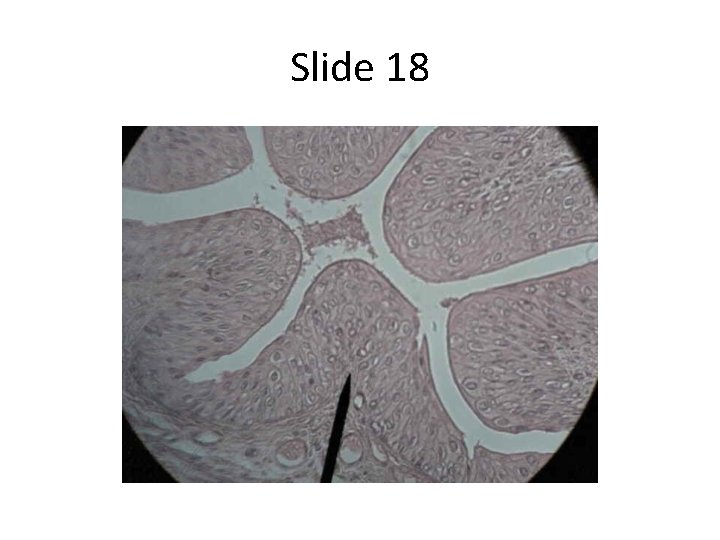 Slide 18 