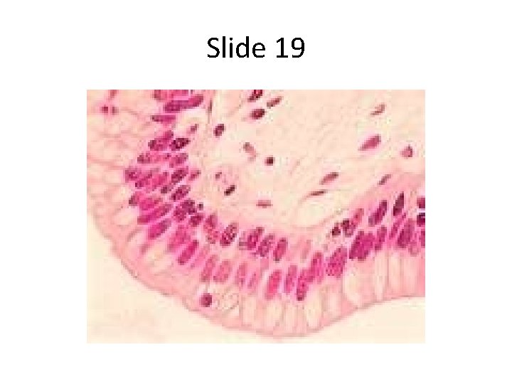 Slide 19 