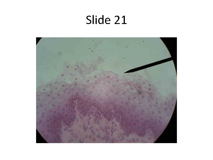 Slide 21 