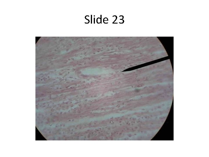 Slide 23 