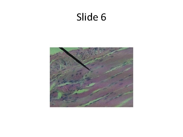 Slide 6 