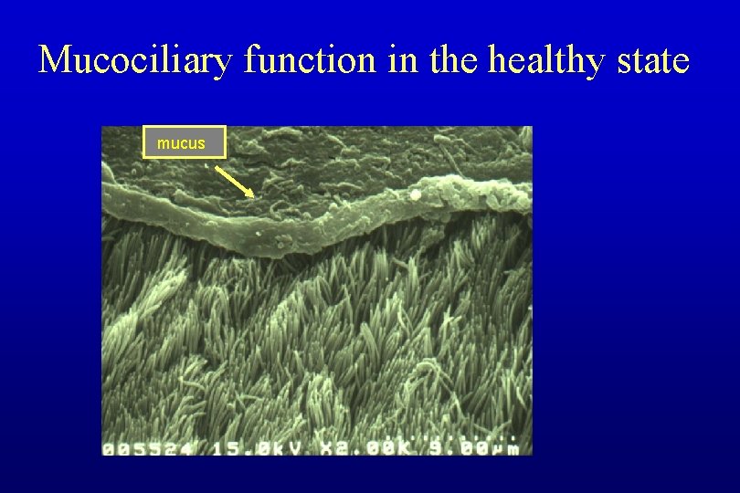 Mucociliary function in the healthy state mucus 