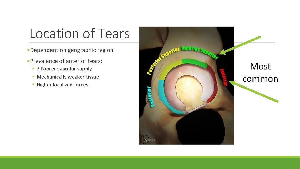 Location of Tears §Dependent on geographic region §Prevalence of anterior tears: § ? Poorer