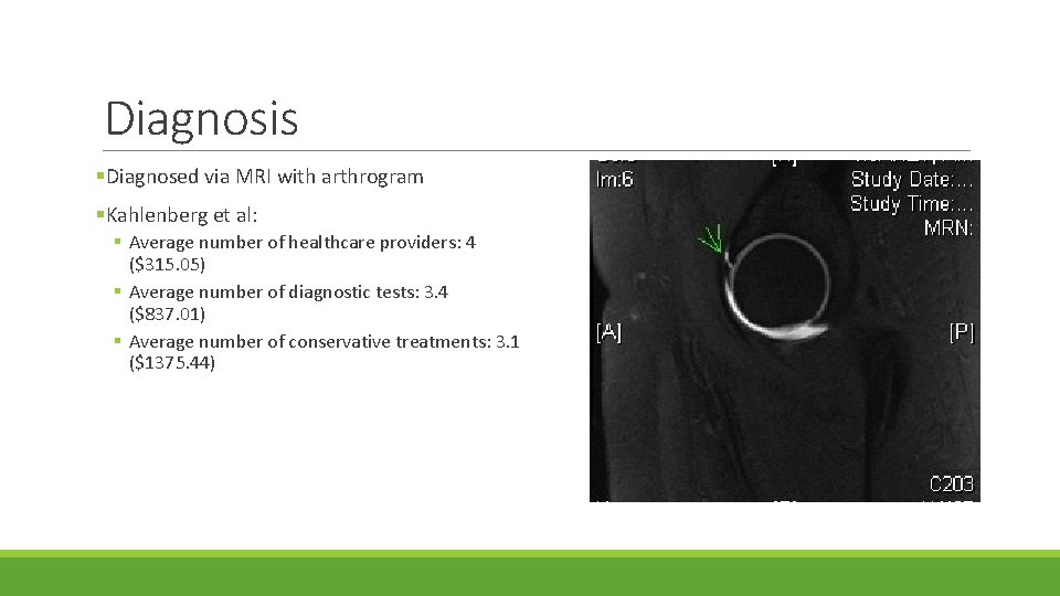 Diagnosis §Diagnosed via MRI with arthrogram §Kahlenberg et al: § Average number of healthcare