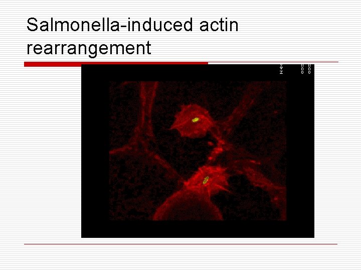 Salmonella-induced actin rearrangement 