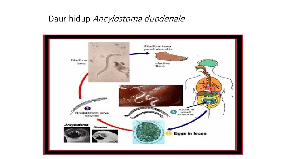 Daur hidup Ancylostoma duodenale 