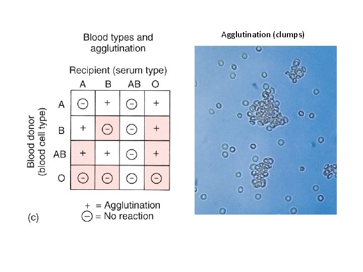 Agglutination (clumps) 