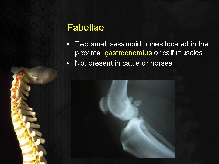 Fabellae • Two small sesamoid bones located in the proximal gastrocnemius or calf muscles.