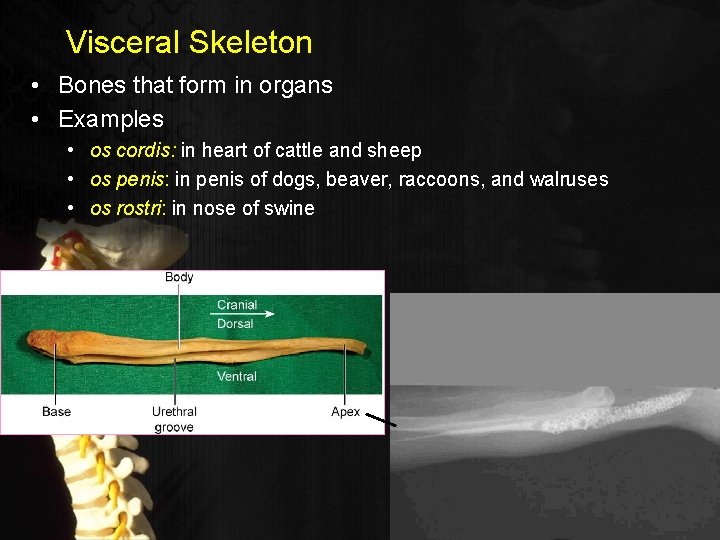Visceral Skeleton • Bones that form in organs • Examples • os cordis: in