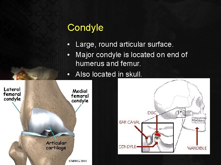 Condyle • Large, round articular surface. • Major condyle is located on end of