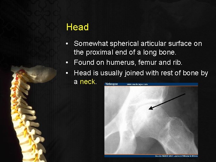 Head • Somewhat spherical articular surface on the proximal end of a long bone.