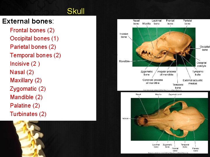 Skull External bones: Frontal bones (2) Occipital bones (1) Parietal bones (2) Temporal bones