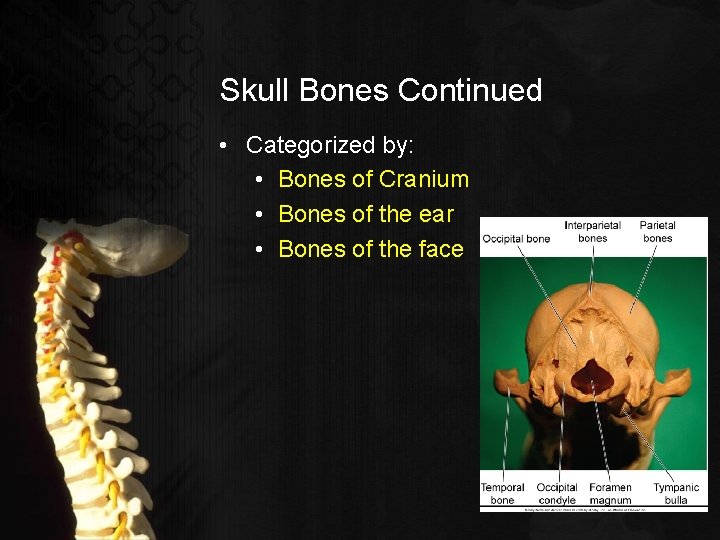 Skull Bones Continued • Categorized by: • Bones of Cranium • Bones of the