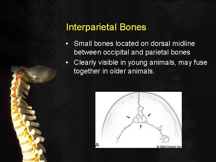 Interparietal Bones • Small bones located on dorsal midline between occipital and parietal bones