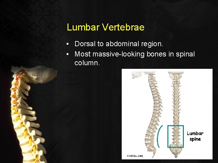 Lumbar Vertebrae • Dorsal to abdominal region. • Most massive-looking bones in spinal column.