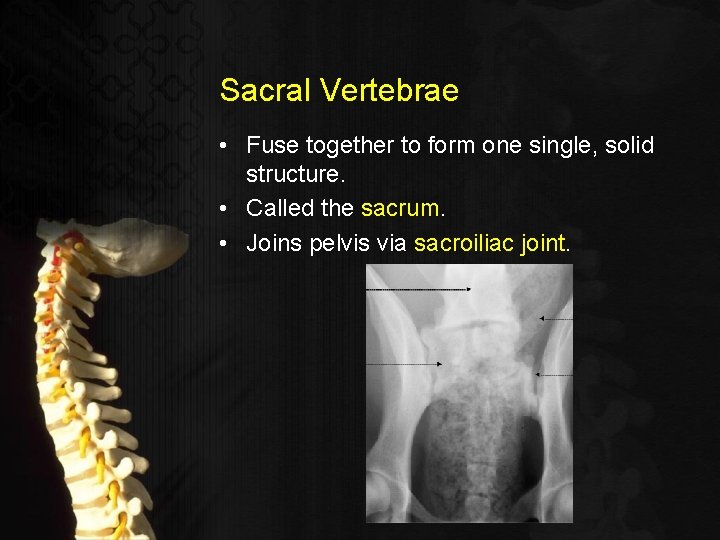 Sacral Vertebrae • Fuse together to form one single, solid structure. • Called the