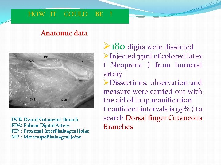 HOW IT COULD BE ! Anatomic data Ø 180 digits were dissected DCB: Dorsal