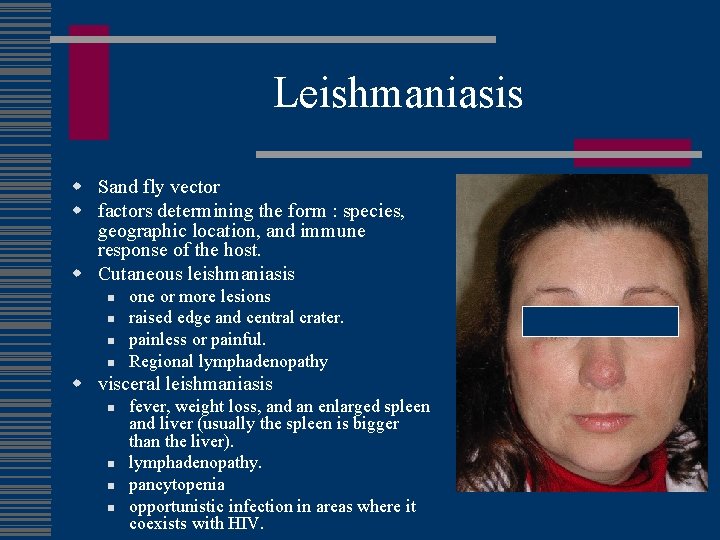 Leishmaniasis w Sand fly vector w factors determining the form : species, geographic location,