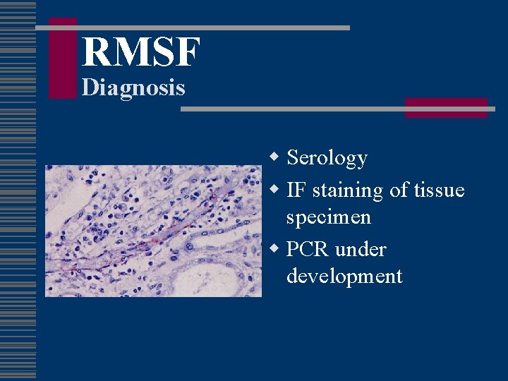 RMSF Diagnosis w Serology w IF staining of tissue specimen w PCR under development