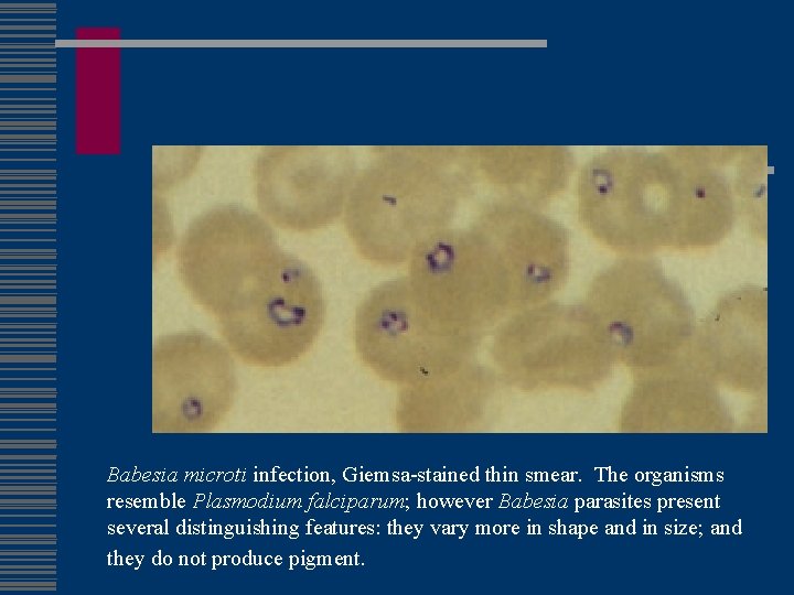 Babesia microti infection, Giemsa-stained thin smear. The organisms resemble Plasmodium falciparum; however Babesia parasites