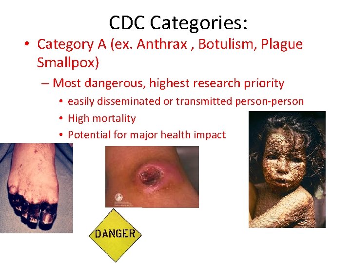 CDC Categories: • Category A (ex. Anthrax , Botulism, Plague Smallpox) – Most dangerous,
