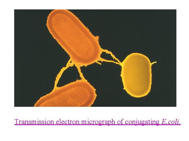 Transmission electron micrograph of conjugating E. coli. 