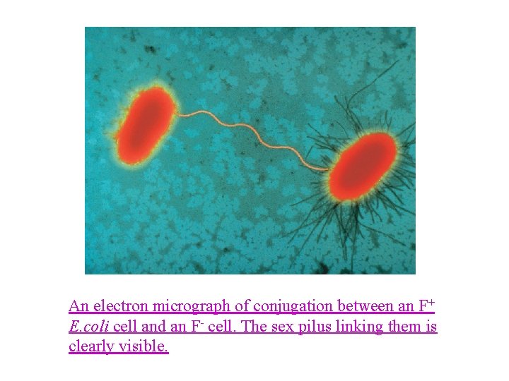 An electron micrograph of conjugation between an F+ E. coli cell and an F-