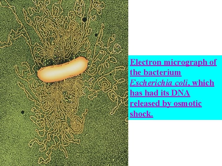 Electron micrograph of the bacterium Escherichia coli, which has had its DNA released by