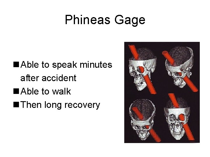 Phineas Gage n Able to speak minutes after accident n Able to walk n