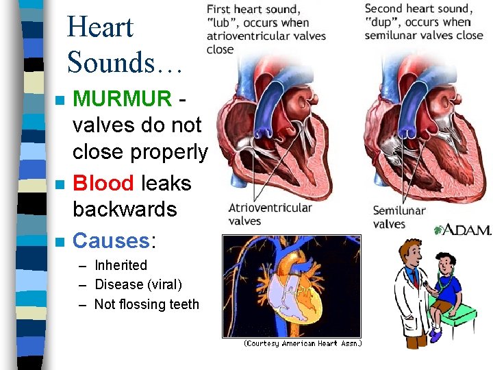 Heart Sounds… n n n MURMUR valves do not close properly Blood leaks backwards