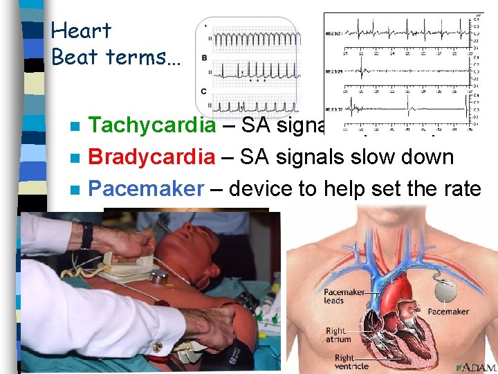 Heart Beat terms… n n n Tachycardia – SA signals speed up Bradycardia –