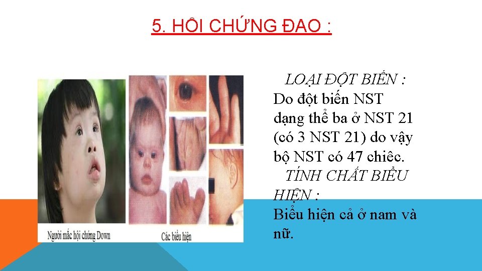 5. HỘI CHỨNG ĐAO : LOẠI ĐỘT BIẾN : Do đột biến NST dạng