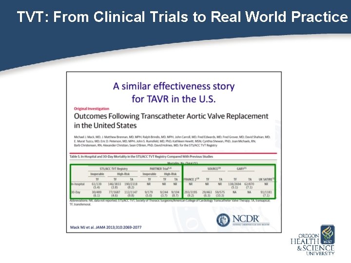 TVT: From Clinical Trials to Real World Practice 