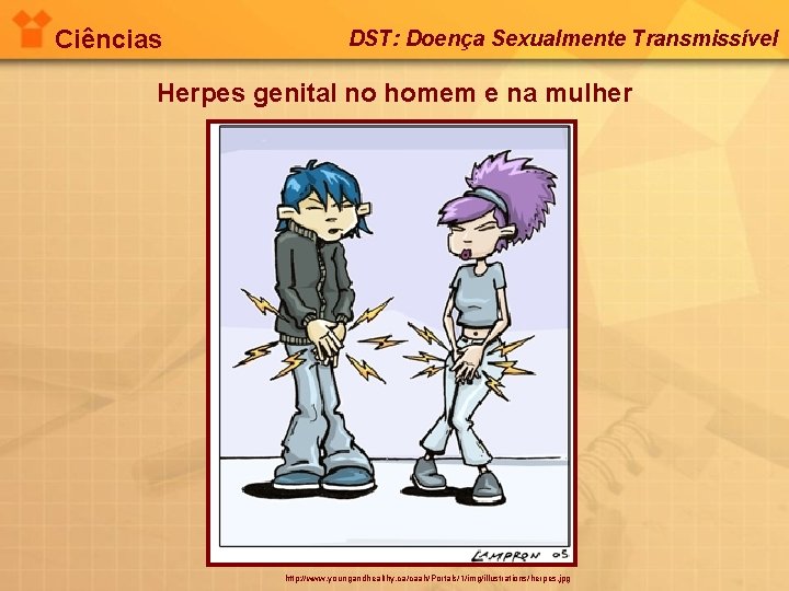 Ciências DST: Doença Sexualmente Transmissível Herpes genital no homem e na mulher http: //www.