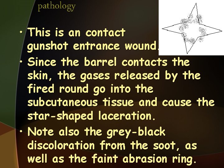 pathology • This is an contact gunshot entrance wound. • Since the barrel contacts