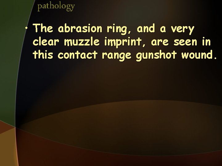 pathology • The abrasion ring, and a very clear muzzle imprint, are seen in