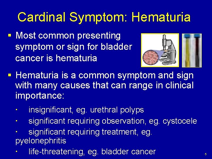 Cardinal Symptom: Hematuria § Most common presenting symptom or sign for bladder cancer is