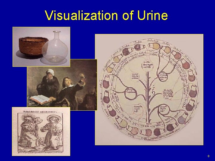 Visualization of Urine 8 