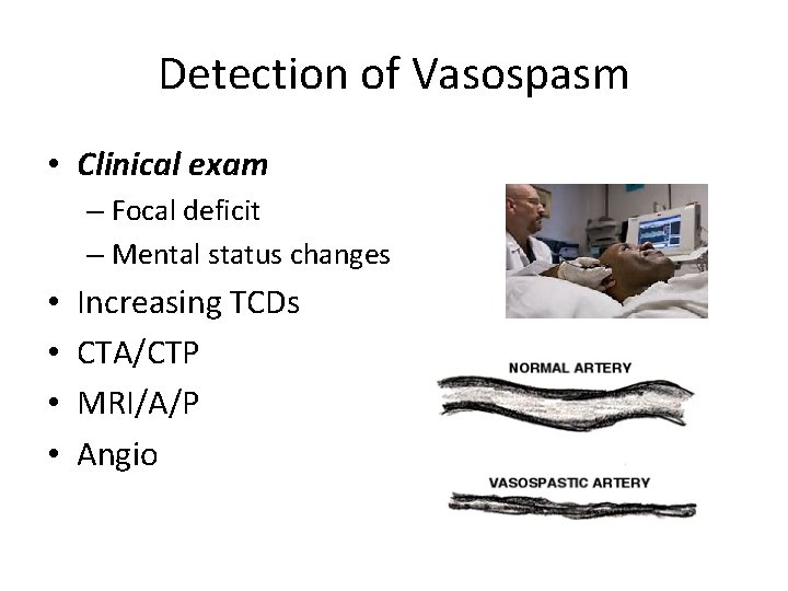 Detection of Vasospasm • Clinical exam – Focal deficit – Mental status changes •