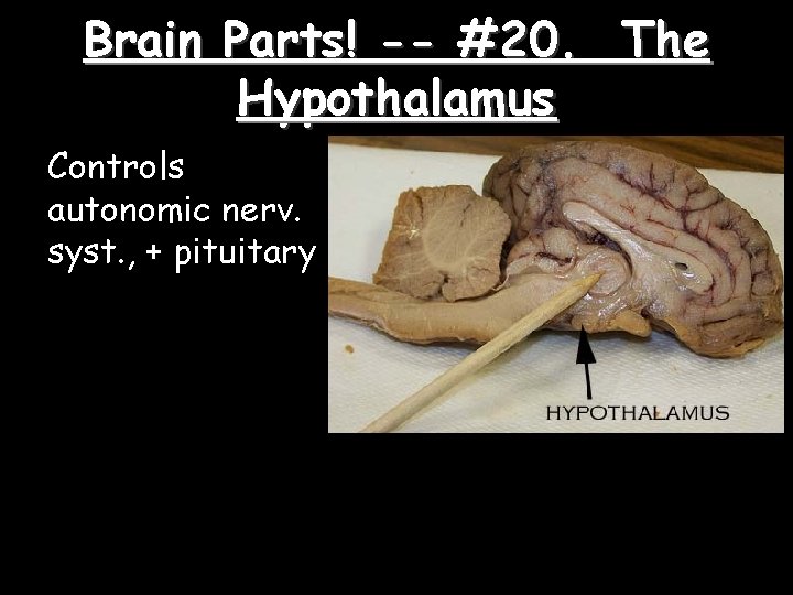 Brain Parts! -- #20. The Hypothalamus Controls autonomic nerv. syst. , + pituitary 