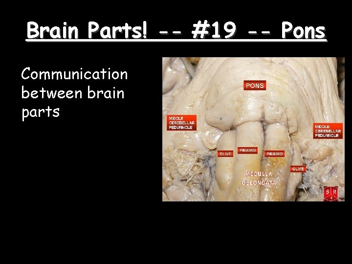 Brain Parts! -- #19 -- Pons Communication between brain parts 