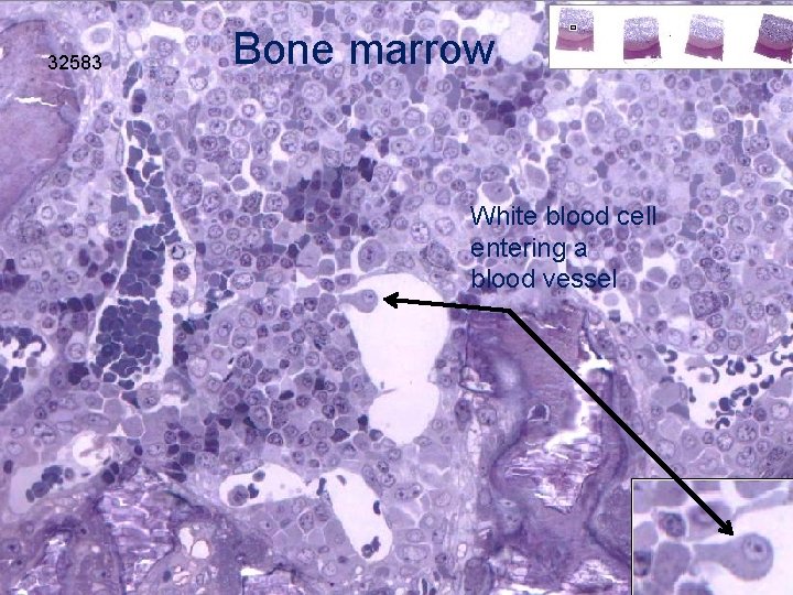 32583 Bone marrow White blood cell entering a blood vessel 