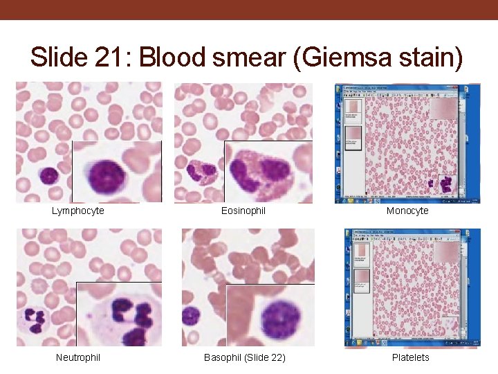 Slide 21: Blood smear (Giemsa stain) Lymphocyte Eosinophil Monocyte Neutrophil Basophil (Slide 22) Platelets