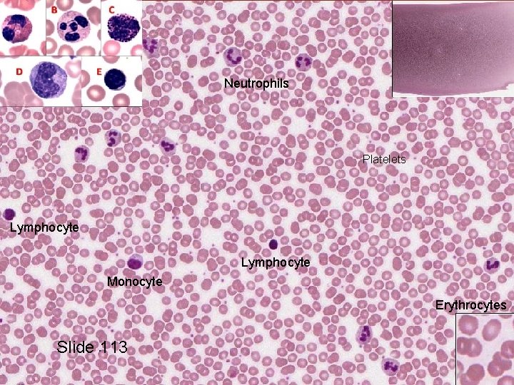 Neutrophils Platelets Lymphocyte Monocyte Erythrocytes Slide 113 