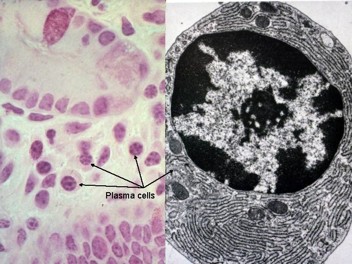 Plasma cells 