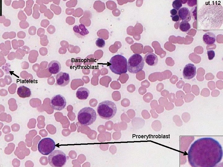 ut 112 Basophilic erythroblast Platelets Proerythroblast 