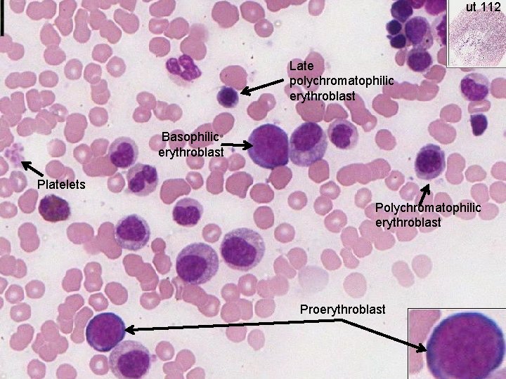 ut 112 Late polychromatophilic erythroblast Basophilic erythroblast Platelets Polychromatophilic erythroblast Proerythroblast 